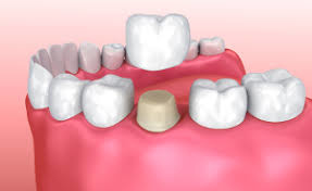 ToothFairy Family Dental, LLC in Plainsboro NJ